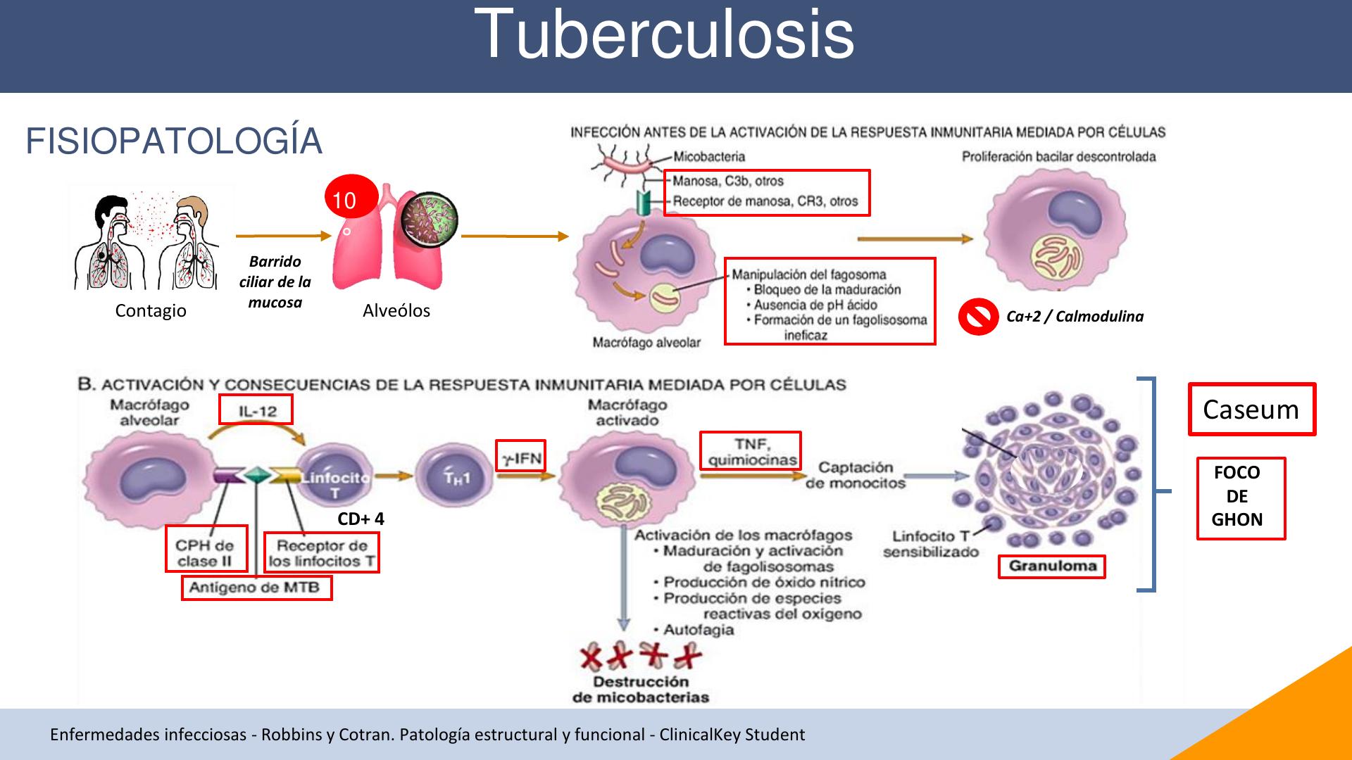 04 TBC pulmonar extrapulmonar y digestiva SOCIMESC | RUTH MICHALLI VARGAS  CANDIA | uDocz